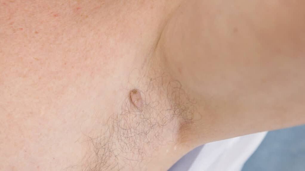 Papilloma de película