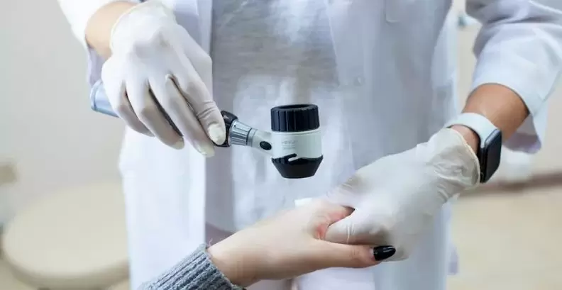 Paciente con verrugas sometido a exame diagnóstico por un dermatólogo